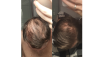 før og etter.png